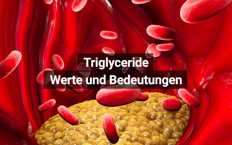 triglyceride zu hoch symptome